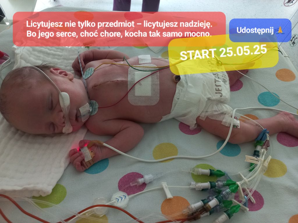 Bazarek dla Ziemka – licytacja charytatywna